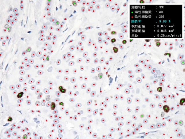 免疫染色標本核内発現バイオマーカー計測支援ソフト e-Count 3